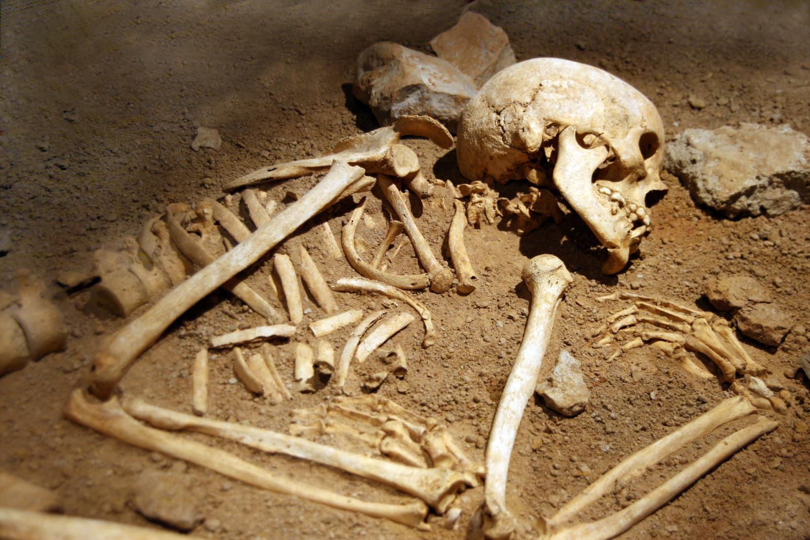bones